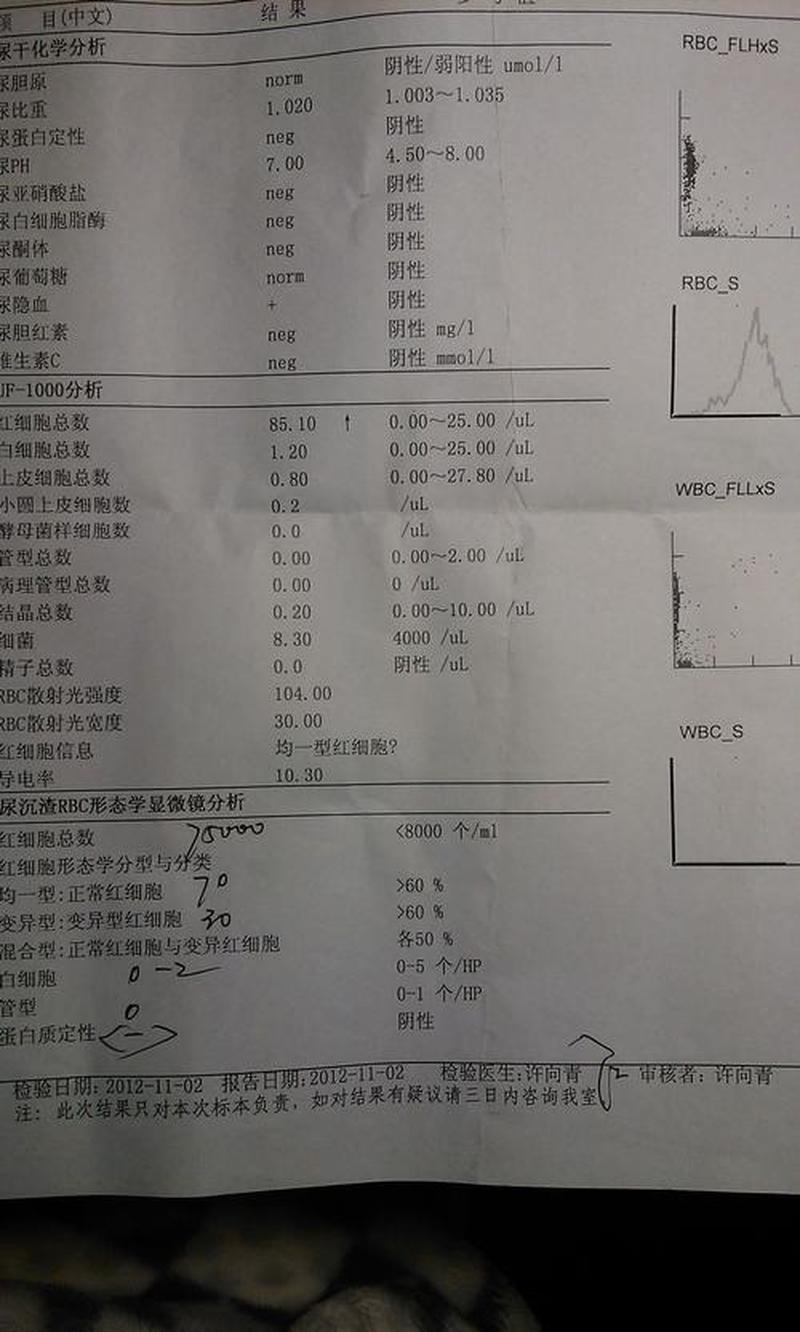 女性尿液红细胞高(女性尿液红细胞高是什么原因造成的)-第1张图片-健康养生经验分享