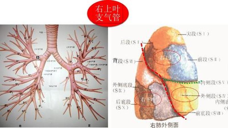 左主支气管_左主支气管：解剖结构与临床相关性探究-第1张图片-健康养生经验分享