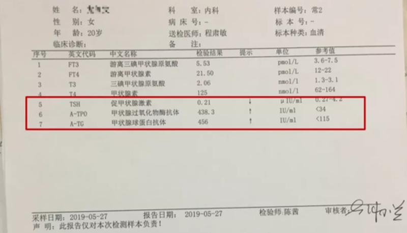 只有tsh高其他正常_甲状腺功能减退症：孤立性促甲状腺激素水平升高-第1张图片-健康养生经验分享