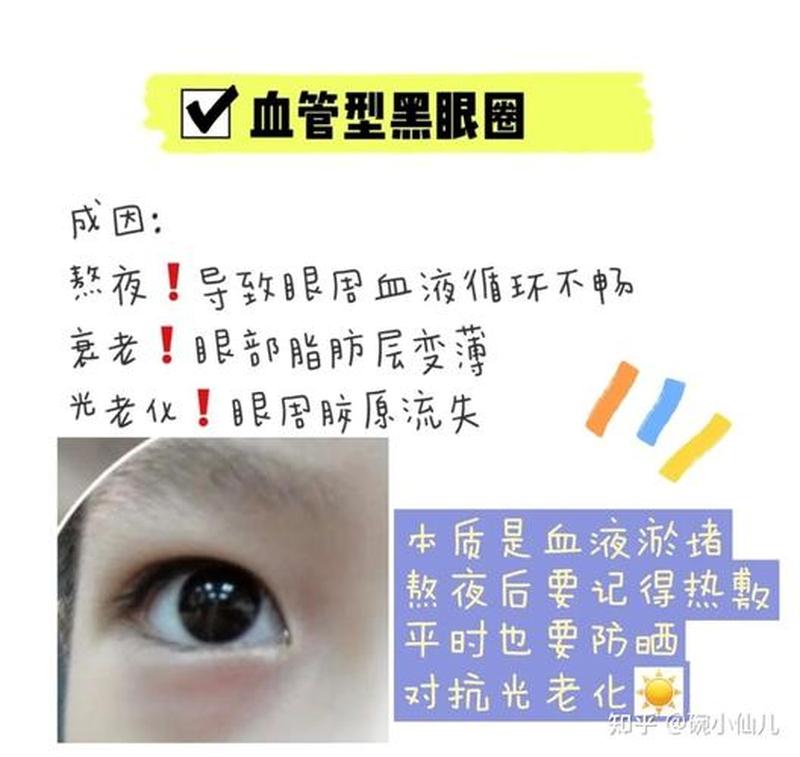 婴儿有黑眼圈是怎么回事_黑眼圈下的婴儿：揭开无眠之夜背后的秘密-第1张图片-健康养生经验分享