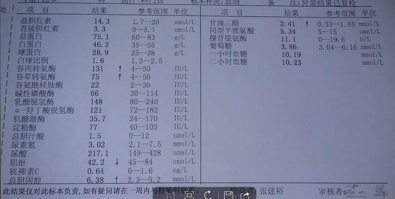 转氨酶高怎么降低(转氨酶高降攻略：六招有效应对)-第1张图片-健康养生经验分享