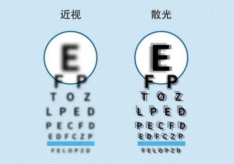 怎样矫正近视眼_怎样矫正近视眼和散光-第1张图片-健康养生经验分享