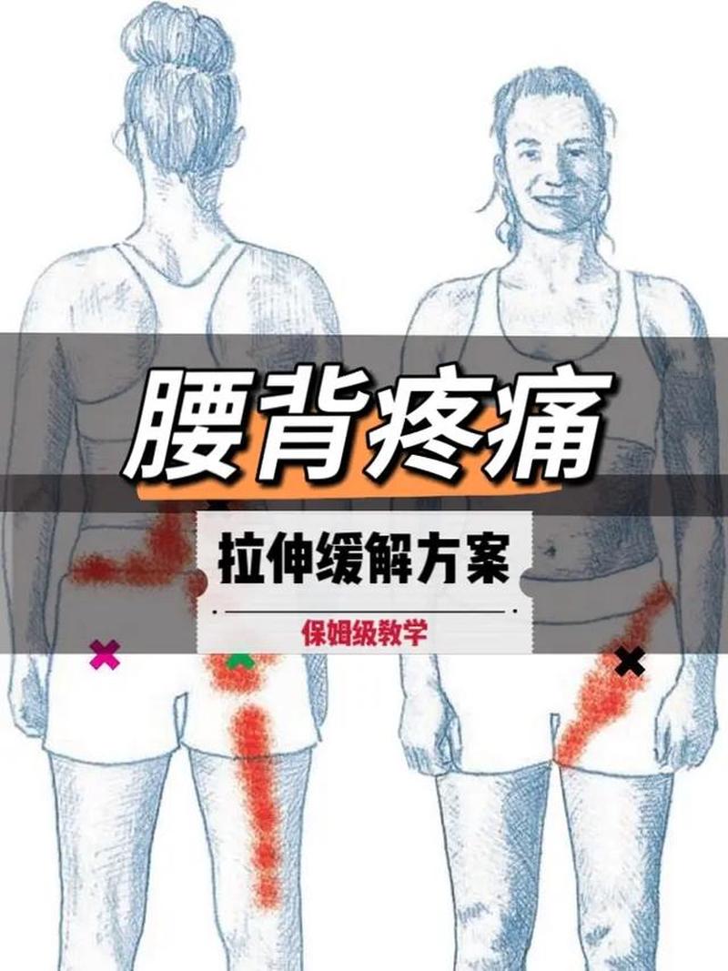 右边腰背疼_右侧腰背部疼痛：原因、症状及治疗方案-第1张图片-健康养生经验分享