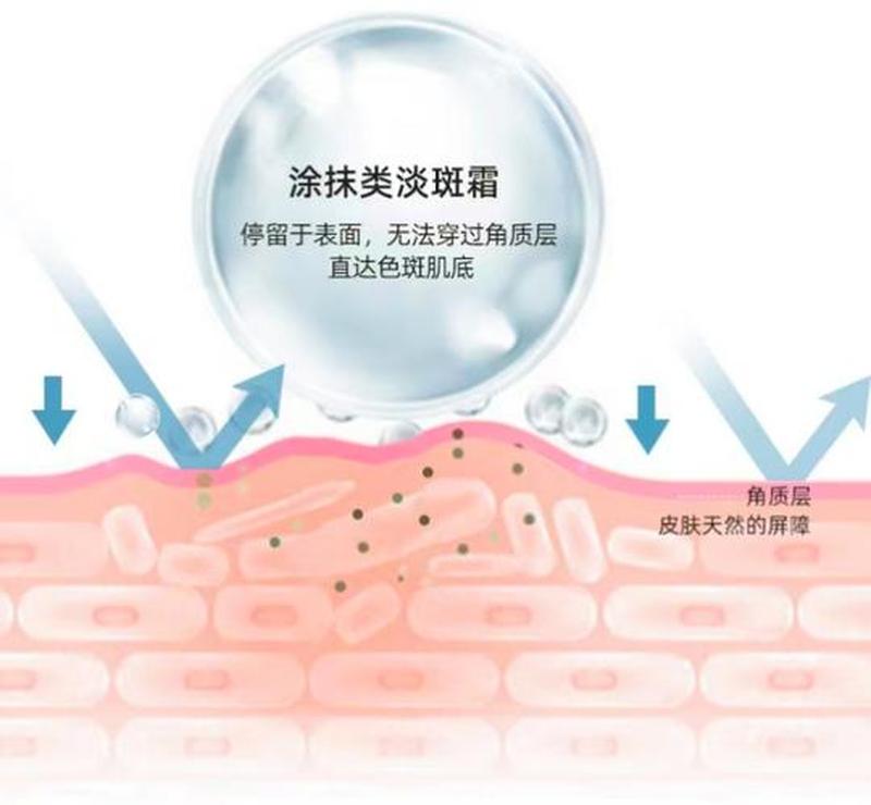 怎样去脸部皱纹(科学护肤除皱纹，焕发青春美肌之路)-第1张图片-健康养生经验分享