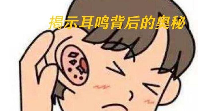 有时耳鸣是什么导致的—耳鸣常相伴 这该往哪说-第1张图片-健康养生经验分享