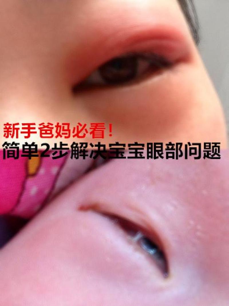 婴儿 稀眼屎—婴儿眼屎多拉稀是什么原因-第1张图片-健康养生经验分享