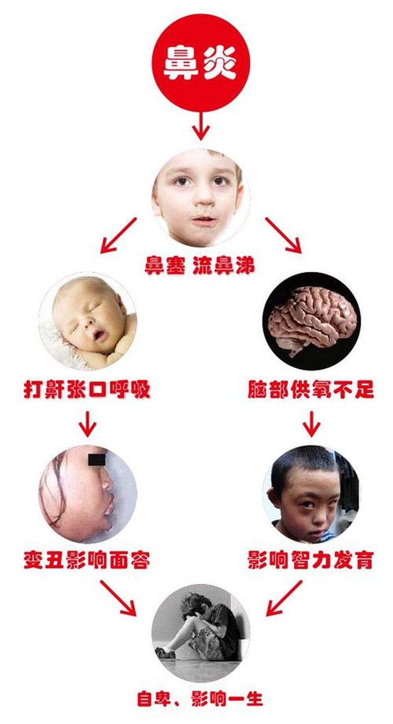 药物性鼻炎怎么办_对抗鼻炎的妙招助你呼吸畅通无阻-第1张图片-健康养生经验分享