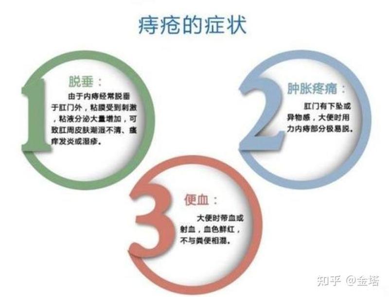 怎么判断痔疮是什么类型—辨别痔疮症状，明确病症知晓-第1张图片-健康养生经验分享