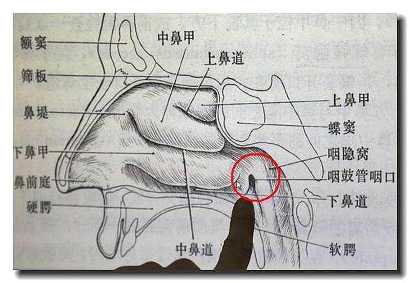 右边鼻孔疼手摸有点硬怎么回事儿—鼻侧顽疼揭示右侧鼻孔之谜-第1张图片-健康养生经验分享