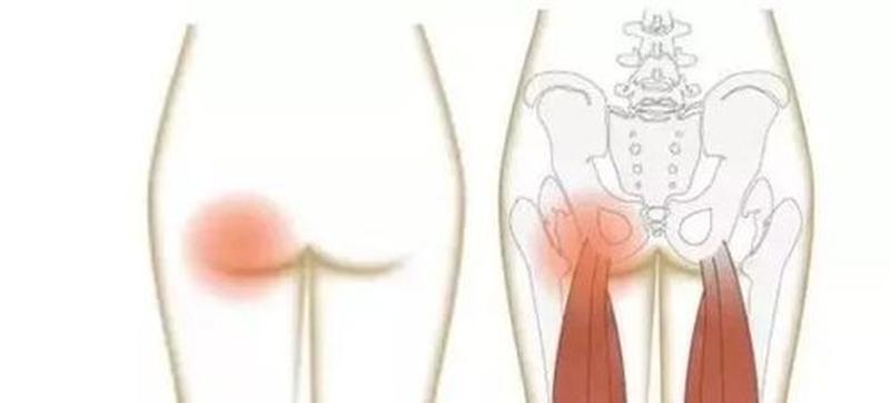 大腿后侧酸痛_睡醒后大腿后侧酸痛-第1张图片-健康养生经验分享