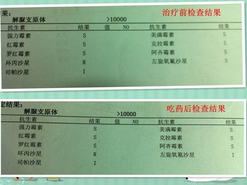 支原体检测_支原体检测报告多久出来-第1张图片-健康养生经验分享