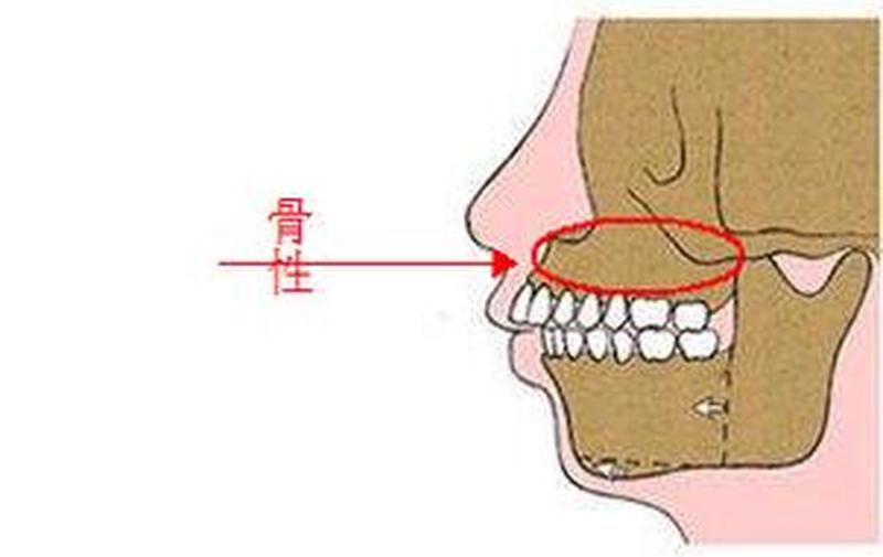 牙齿长上面了怎么下移_齿轮反转：牙齿长上了当道-第1张图片-健康养生经验分享