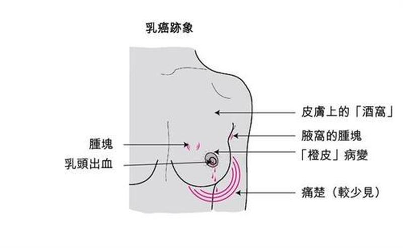 在下面疼是怎么回事_暗涌之痛：揭秘隐匿不宣的乳腺隐痛-第1张图片-健康养生经验分享