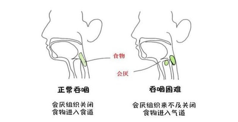 孕13周有褐色分泌物—孕13周有褐色分泌物会流产吗-第1张图片-健康养生经验分享