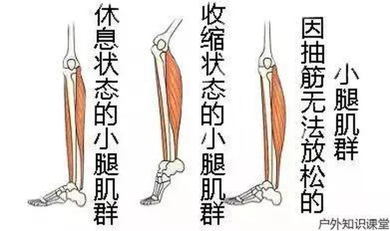 运动容易抽筋_运动抽筋 克服隐患 轻松畅跑-第1张图片-健康养生经验分享