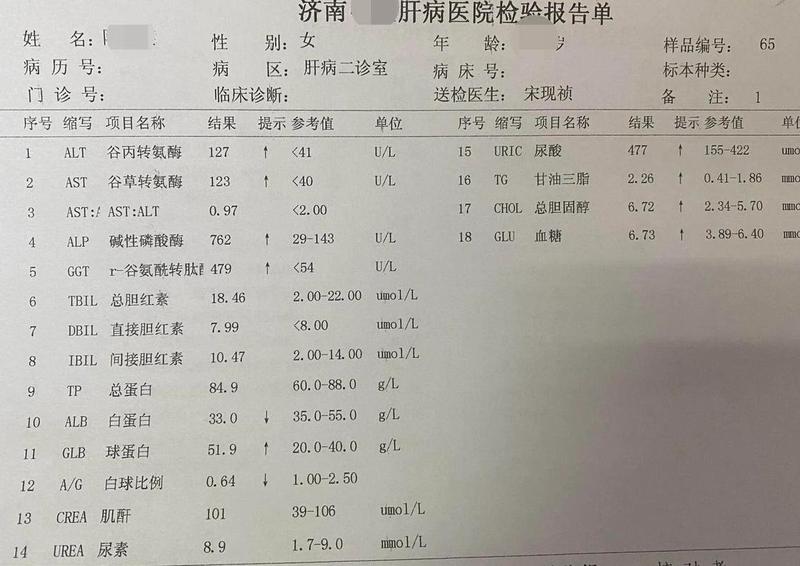 转氨酶特别好_转氨酶健康亮眼 展现肝脏活力巅峰-第1张图片-健康养生经验分享