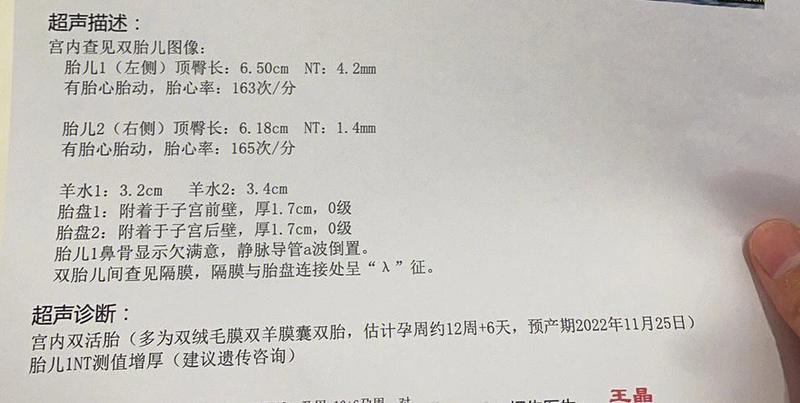 引产是什么意思是流产吗_引产：终止妊娠之关键密钥-第1张图片-健康养生经验分享