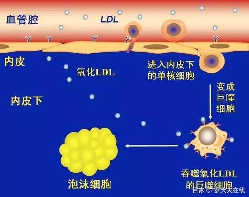 怎样降低脂蛋白a700(解锁降脂蛋白a秘诀：科学 *** 化解心血管隐忧)-第1张图片-健康养生经验分享