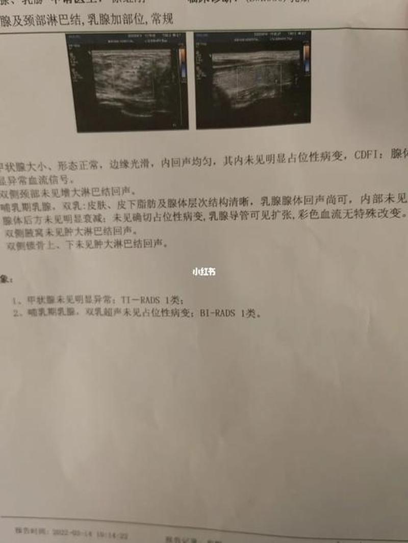 左边奶有硬块_左侧肿块，需警惕乳腺异常-第1张图片-健康养生经验分享