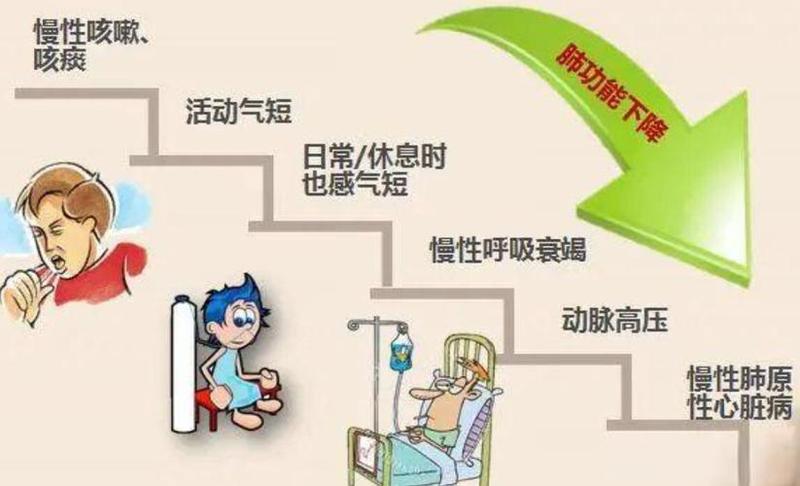 早上起床有痰—晨起痰鸣呼吁呼吸道健康-第1张图片-健康养生经验分享