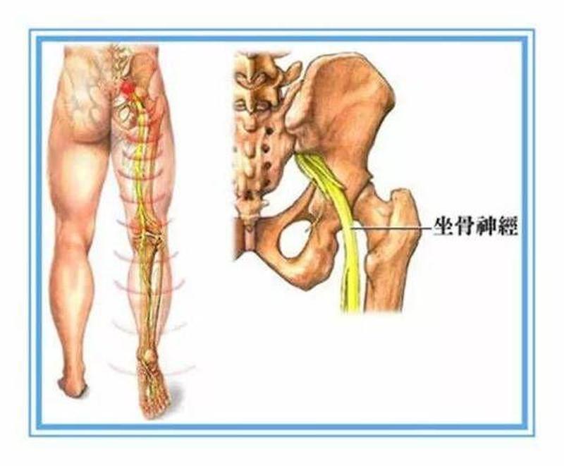 右侧臀部酸痛(右侧臀部酸痛挂什么科)-第1张图片-健康养生经验分享