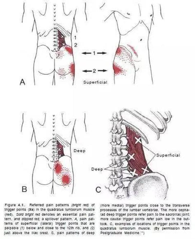 腰部肌肉痛_腰部肌肉之痛：成因解析与缓解之道-第1张图片-健康养生经验分享