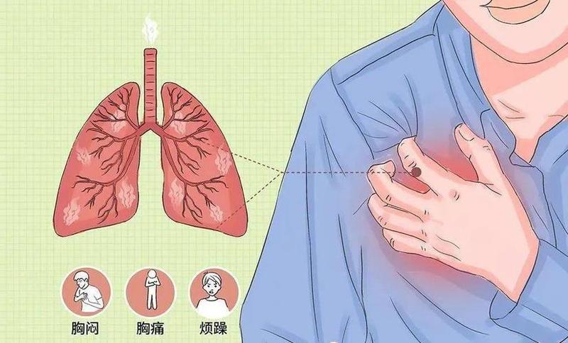 走几步就喘不过气—走几步就喘不过气是怎么回事心跳加速-第1张图片-健康养生经验分享