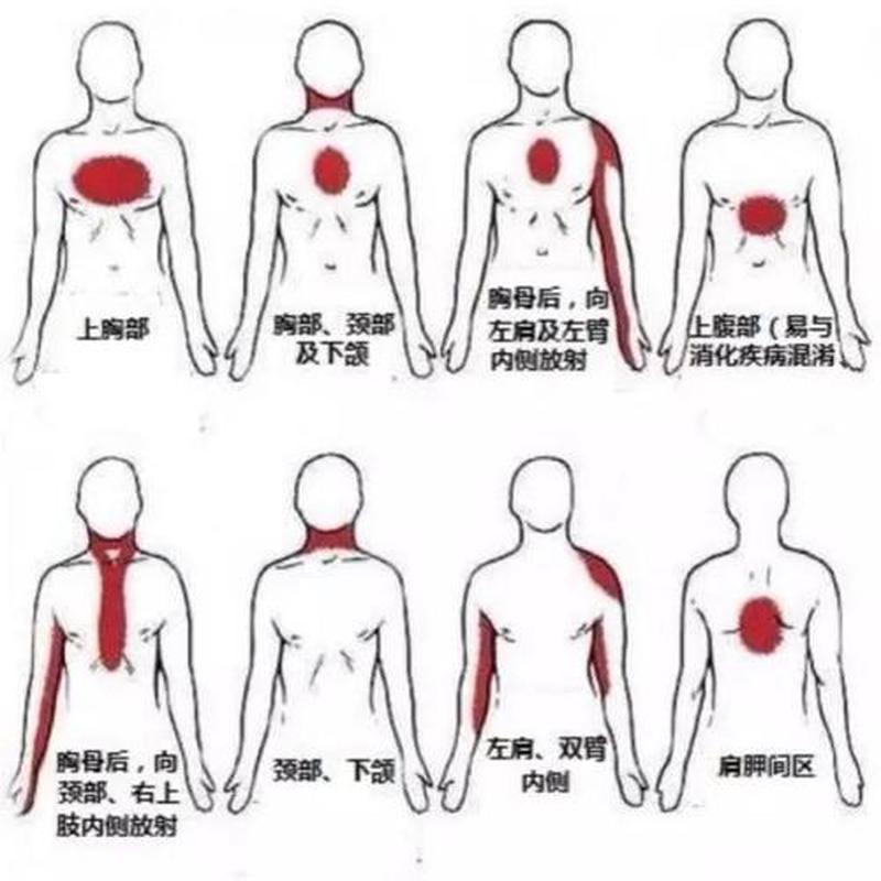 左侧里面疼_左侧里面疼是心脏还是疼-第1张图片-健康养生经验分享
