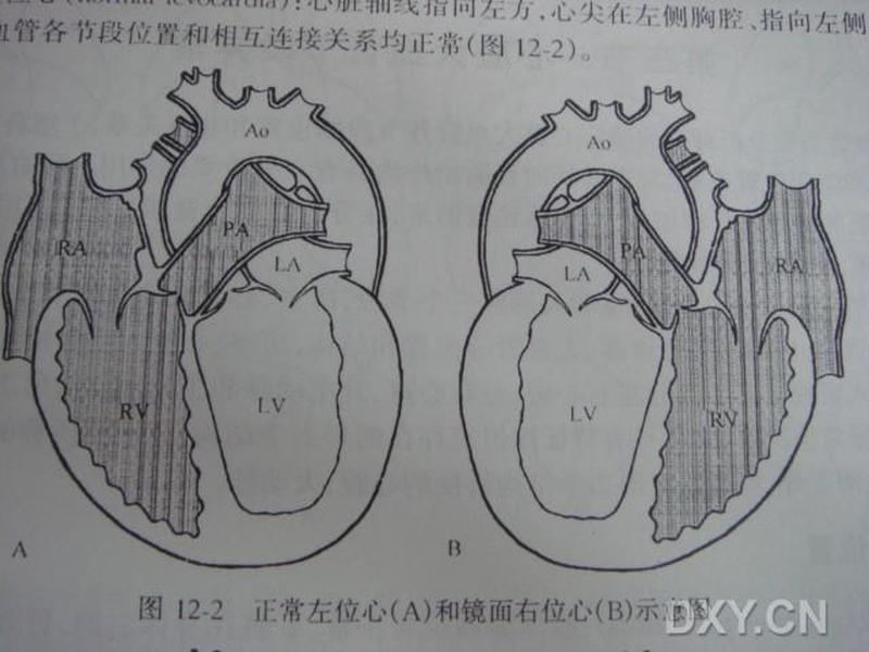 右位心影响寿命吗_右位心：从出生到永恒的旅程-第1张图片-健康养生经验分享