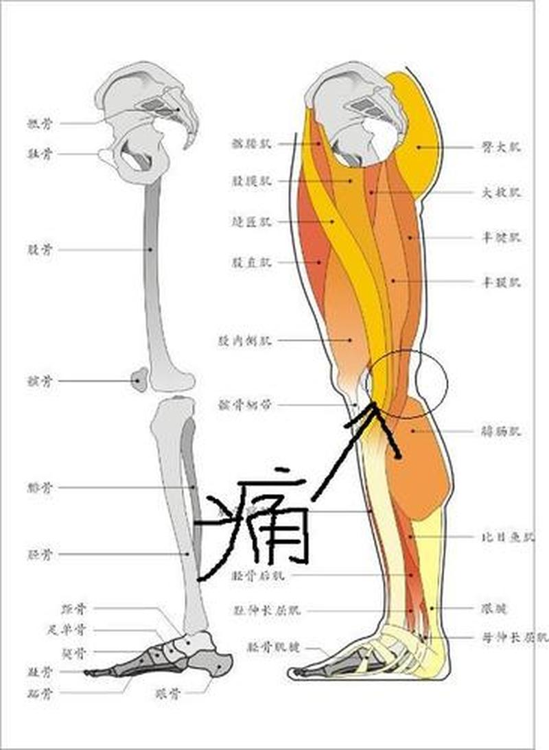 左大腿外侧肌肉疼痛(左大腿外侧肌肉疼痛要警惕)-第1张图片-健康养生经验分享