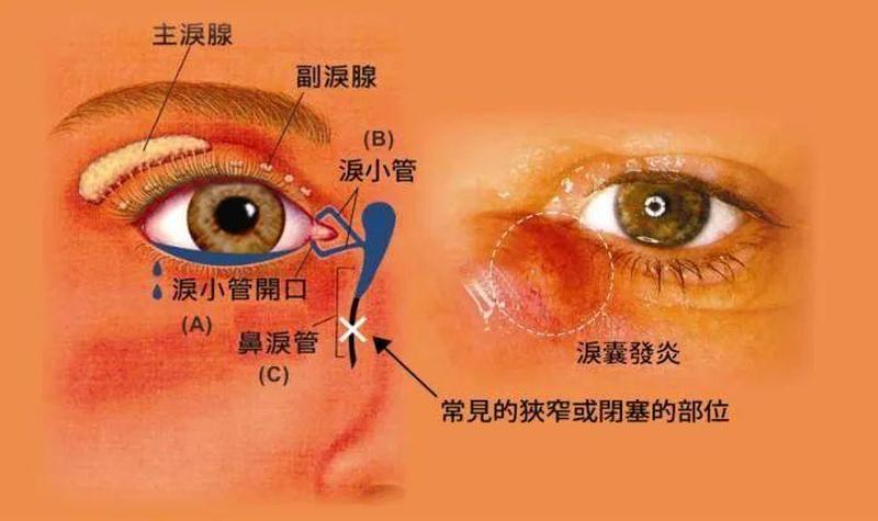 总是有眼屎(为什么总是有眼屎)-第1张图片-健康养生经验分享