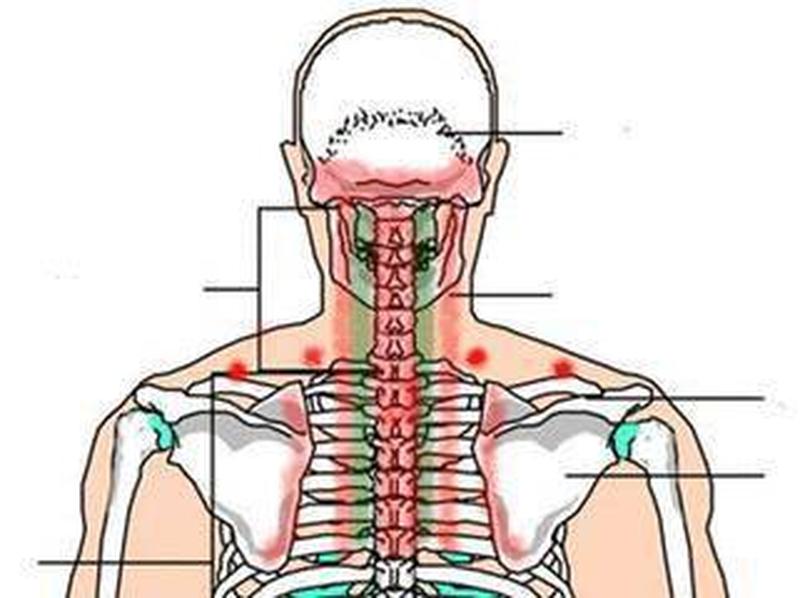 左边后背酸痛_左边后背酸痛厉害引起头痛心脏不舒服-第1张图片-健康养生经验分享