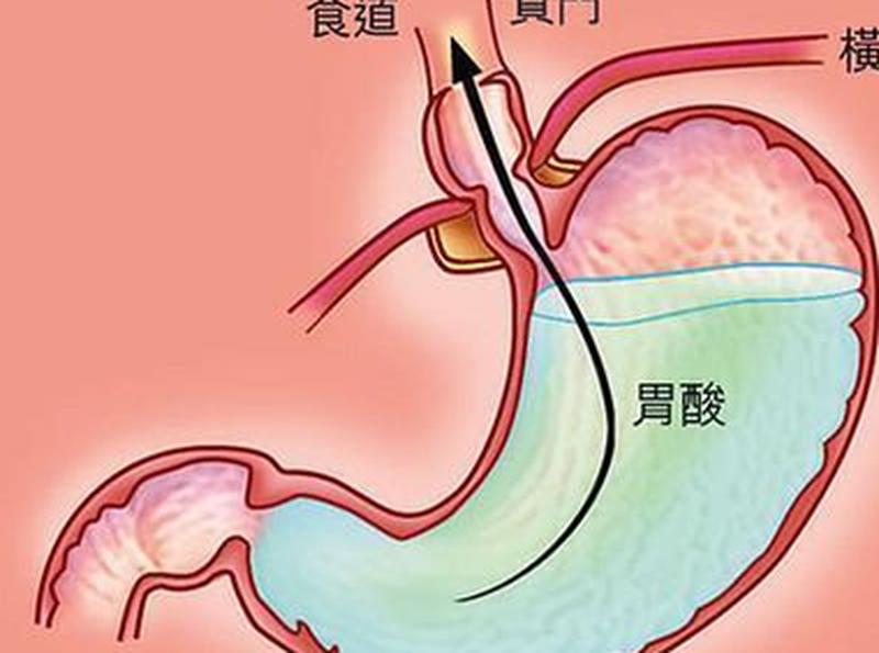 最近总胃酸(总胃酸之谜：健康与疾病的双刃剑)-第1张图片-健康养生经验分享