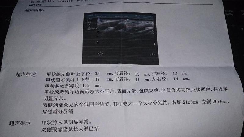 右侧脖子里面疼_右侧颈部疼痛：隐匿的病因，不可忽视-第1张图片-健康养生经验分享