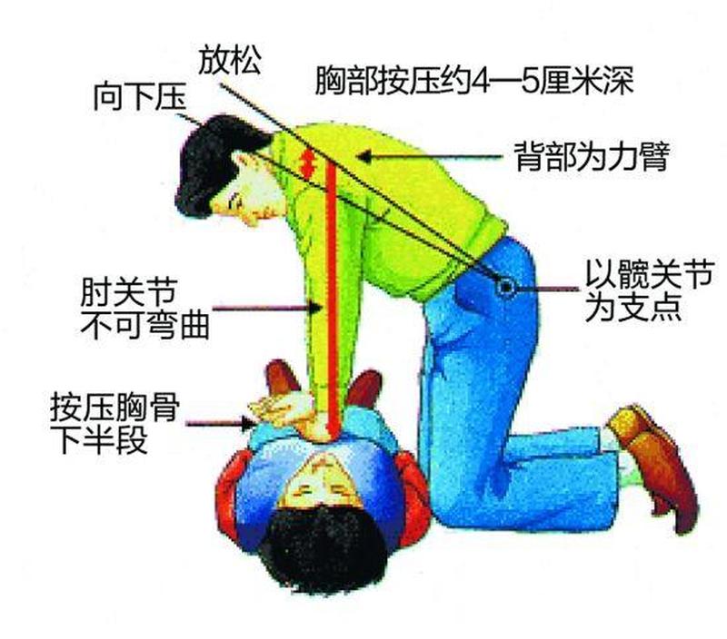 心肺复苏名词解释_心肺复苏术：挽救生命的紧急求生指南-第1张图片-健康养生经验分享