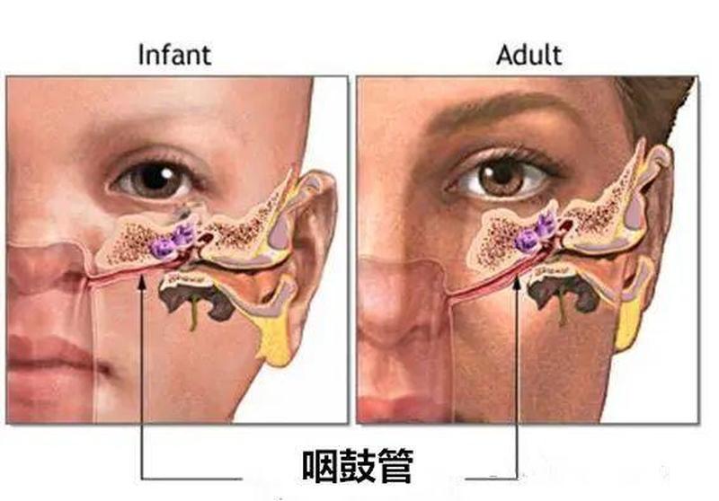 中耳炎能根治吗仁品地址_中耳炎的福音：彻底根治还是遥不可及？-第1张图片-健康养生经验分享