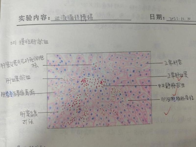 淤血名词解释病理生理学—淤血滞留：病理根源与临床影响探讨-第1张图片-健康养生经验分享