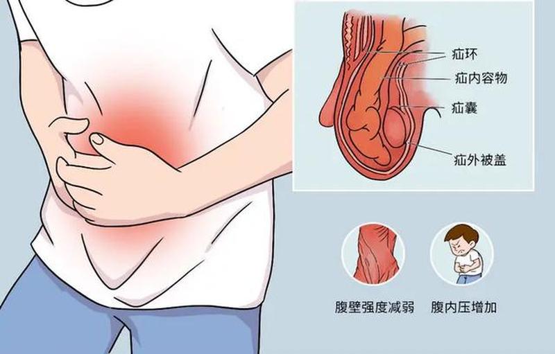 怀孕后小腹涨_怀孕以后小腹胀胀的-第1张图片-健康养生经验分享