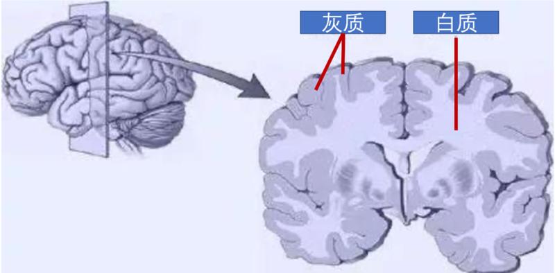 右侧额叶脑白质脱髓鞘(右侧额叶脑白质脱髓鞘灶)-第1张图片-健康养生经验分享