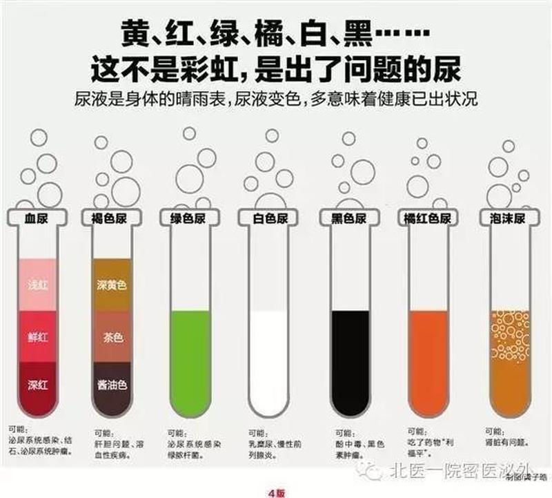 尿黄眼睛肿(尿色异常眼肿惊魂 揭秘背后隐藏隐患)-第1张图片-健康养生经验分享