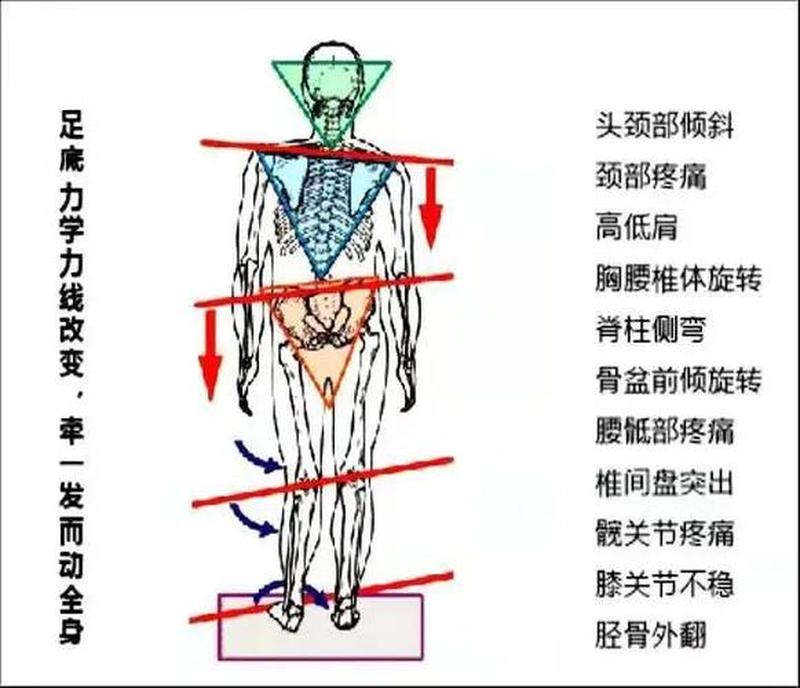 走路脚疼筋疼_足步生疼，筋骨作祟：解锁行走自由-第1张图片-健康养生经验分享