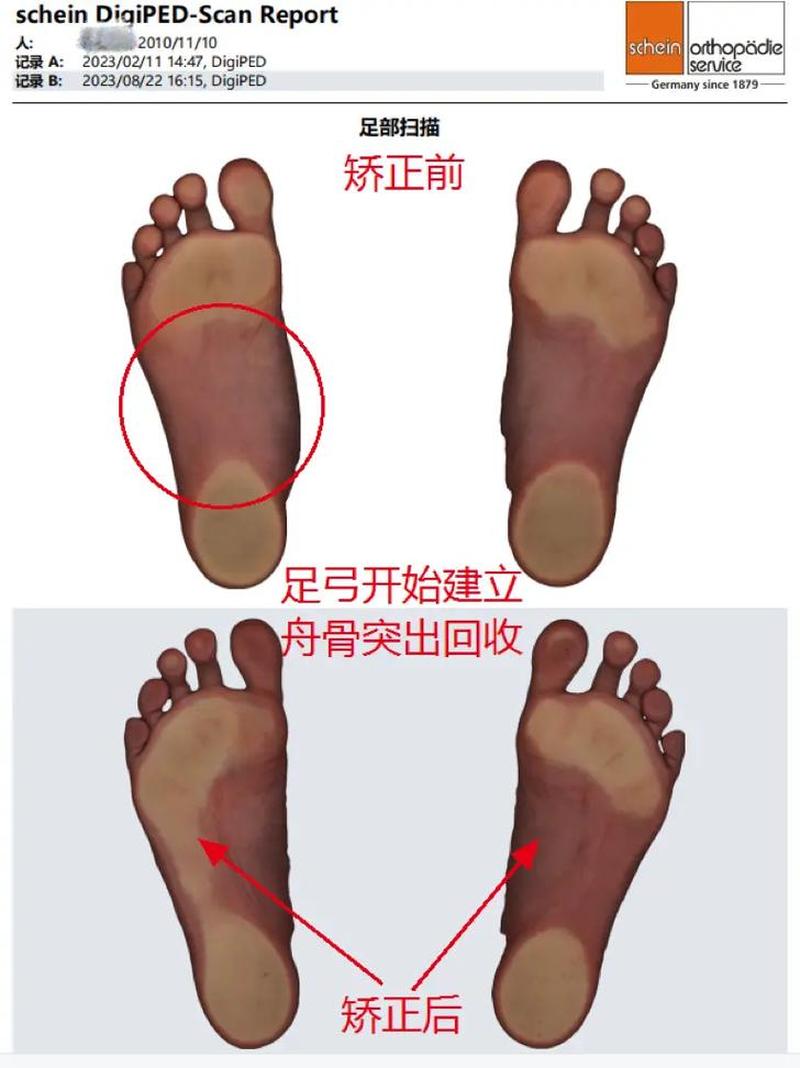 足弓处酸痛(足弓酸痛怎么缓解)-第1张图片-健康养生经验分享