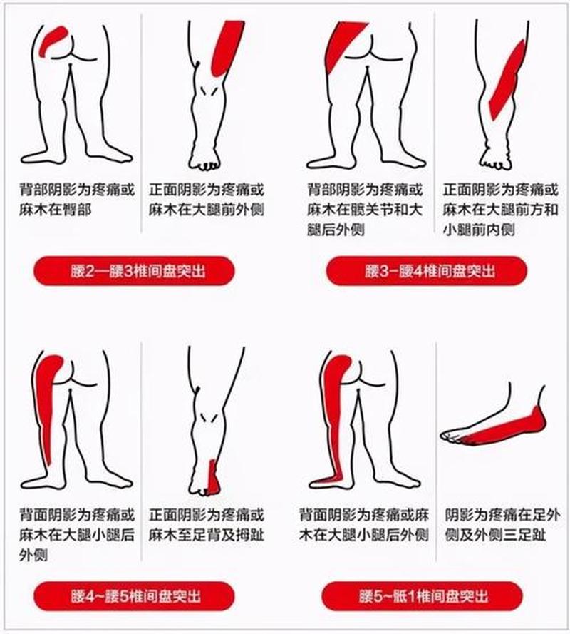 走路 *** 痛_走路 *** 痛腿痛怎么办-第1张图片-健康养生经验分享