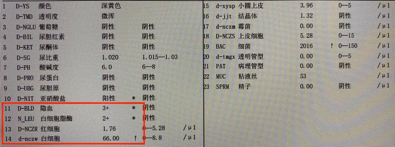 孕妇尿液红细胞高(孕妇尿液红细胞高怎么办)-第1张图片-健康养生经验分享