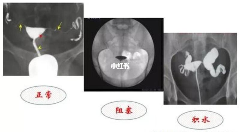 照影是什么意思—照影何物：从光影到心灵的自我发现之旅-第1张图片-健康养生经验分享