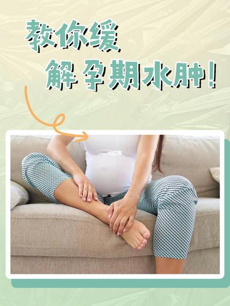 孕妇怀孕腿肿正常吗—孕期腿肿：原因、护理和缓解 *** -第1张图片-健康养生经验分享